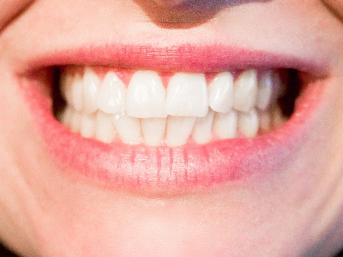 Obecna technika stosowana w salonach stomatologii estetycznej być może sprawić, że odzyskamy prześliczny uśmiech.